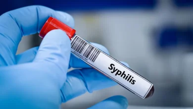 Sífilis