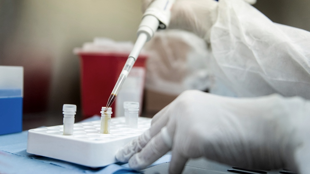 Argentina fue elegida para probar una vacuna contra el coronavirus